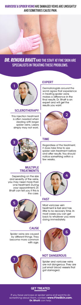 Spider Vein Treatment Near Me | Fine Skin Dermatology