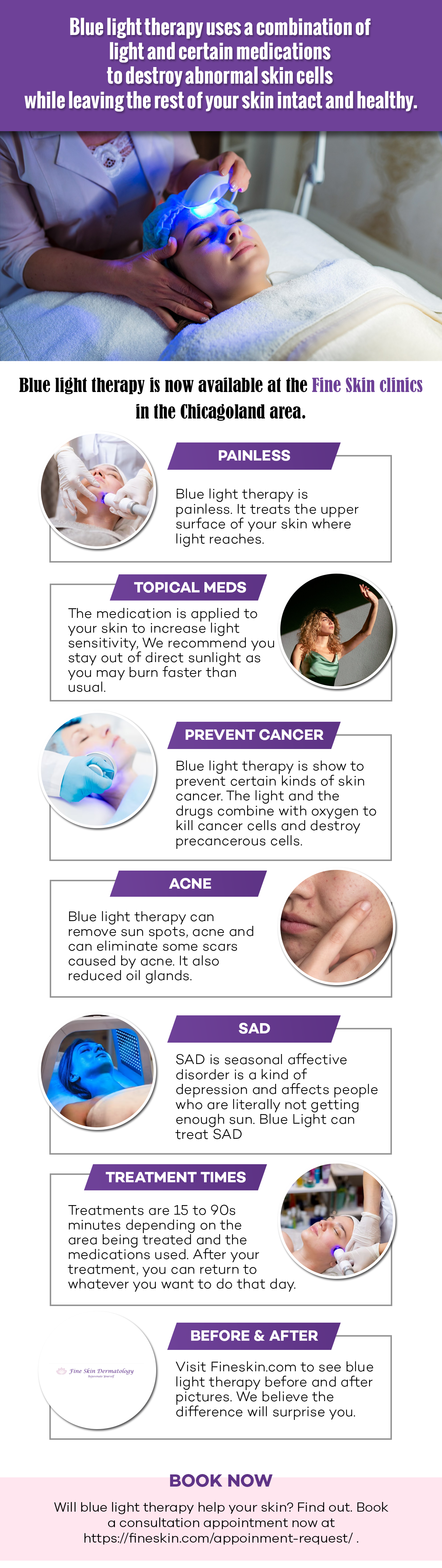 FAQs About Blue Light Therapy For Precancerous Skin Lesions