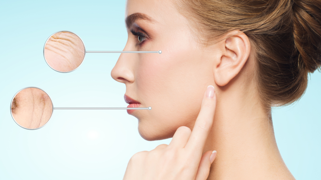 Juvederm removes signs of aging