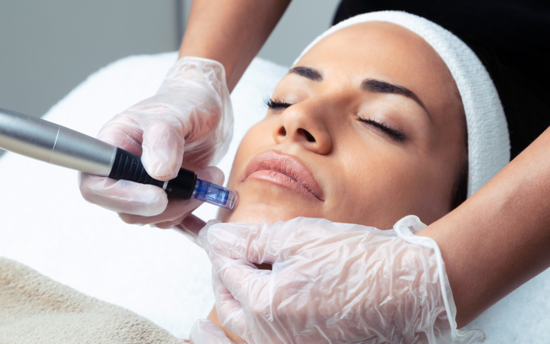 Microneedling with PRP near me